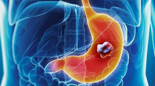 Foto - Bu 8 berti kanser habercisi olabilir