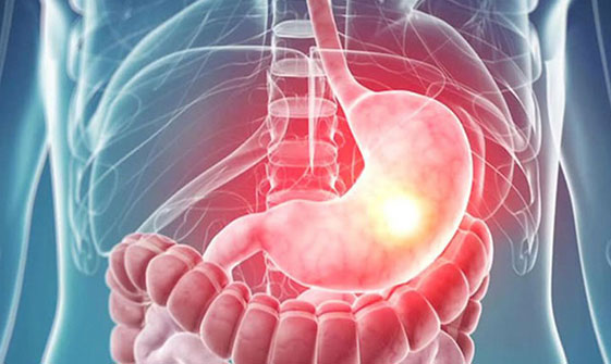 Foto - Bu 8 berti kanser habercisi olabilir