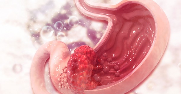 Foto - Bu 8 berti kanser habercisi olabilir