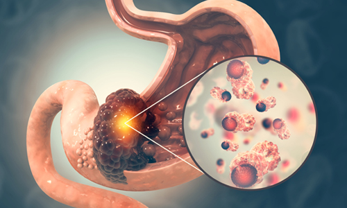 Bu 8 berti kanser habercisi olabilir