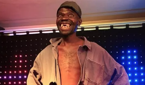 Bu adamın sonu herkesi şaşırttı! Akıllara durgunluk veren olay: 4 kez dünyanın en çirkin insanı…