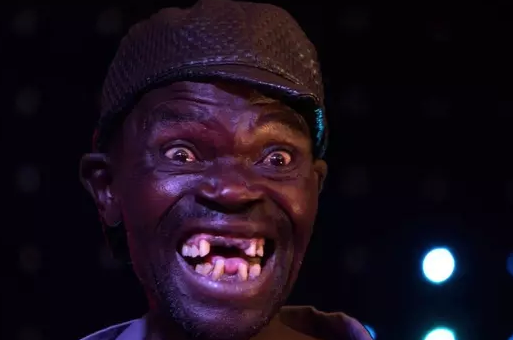 Foto - Bu adamın sonu herkesi şaşırttı! Akıllara durgunluk veren olay: 4 kez dünyanın en çirkin insanı…