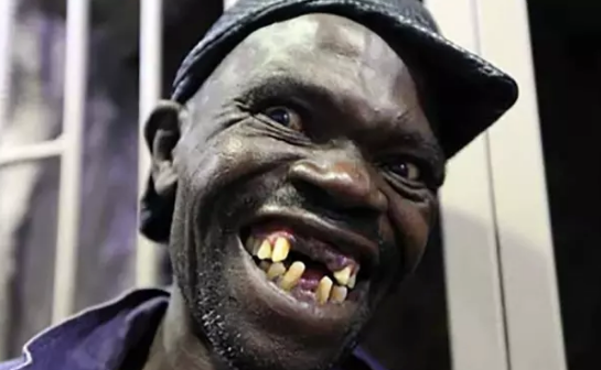 Foto - Bu adamın sonu herkesi şaşırttı! Akıllara durgunluk veren olay: 4 kez dünyanın en çirkin insanı…