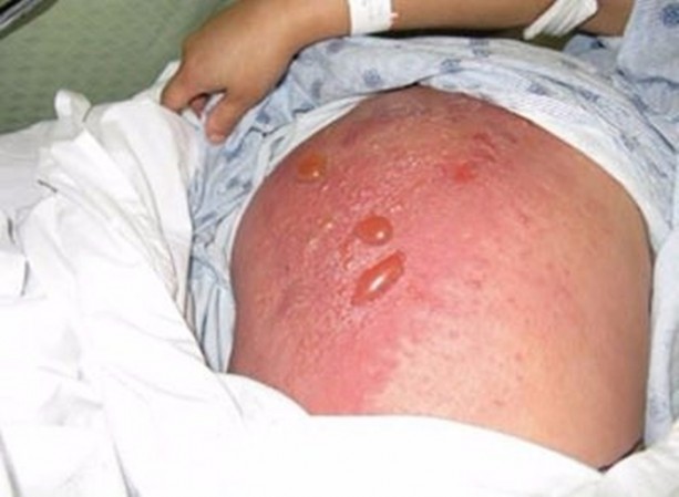 Foto - Bu ağaca dokunan sakat kalıyor!