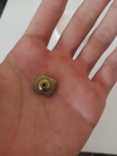 Foto - Bu ameliyat Türkiye'de yapıldı! Tıp literatüründe ender görülen olay