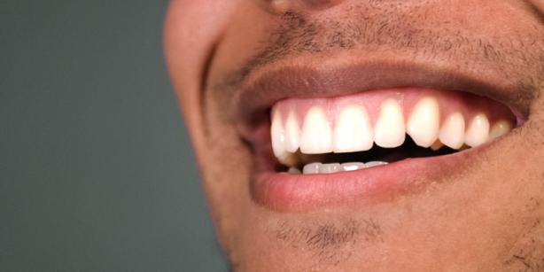 Foto - Bu aylarda dikkat! Dondurmayı asla böyle tüketmeyin