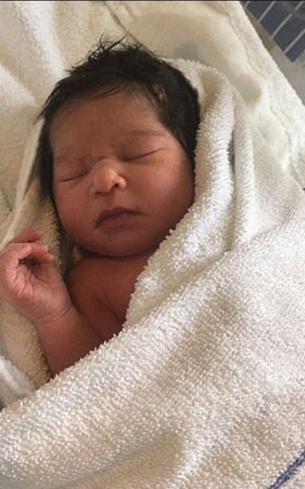 Foto - Bu bebeği görenler gözlerine inanamıyor!