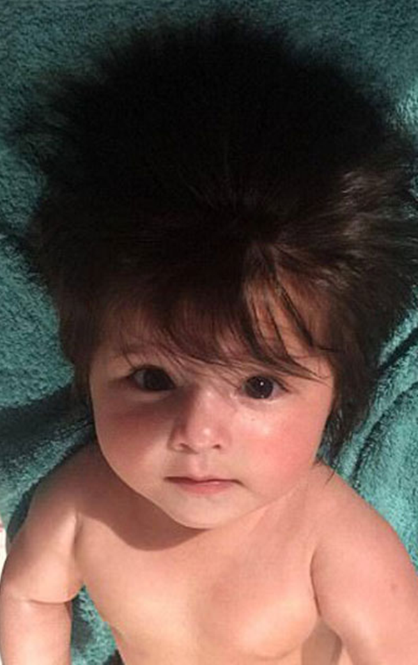 Foto - Bu bebeği görenler gözlerine inanamıyor!