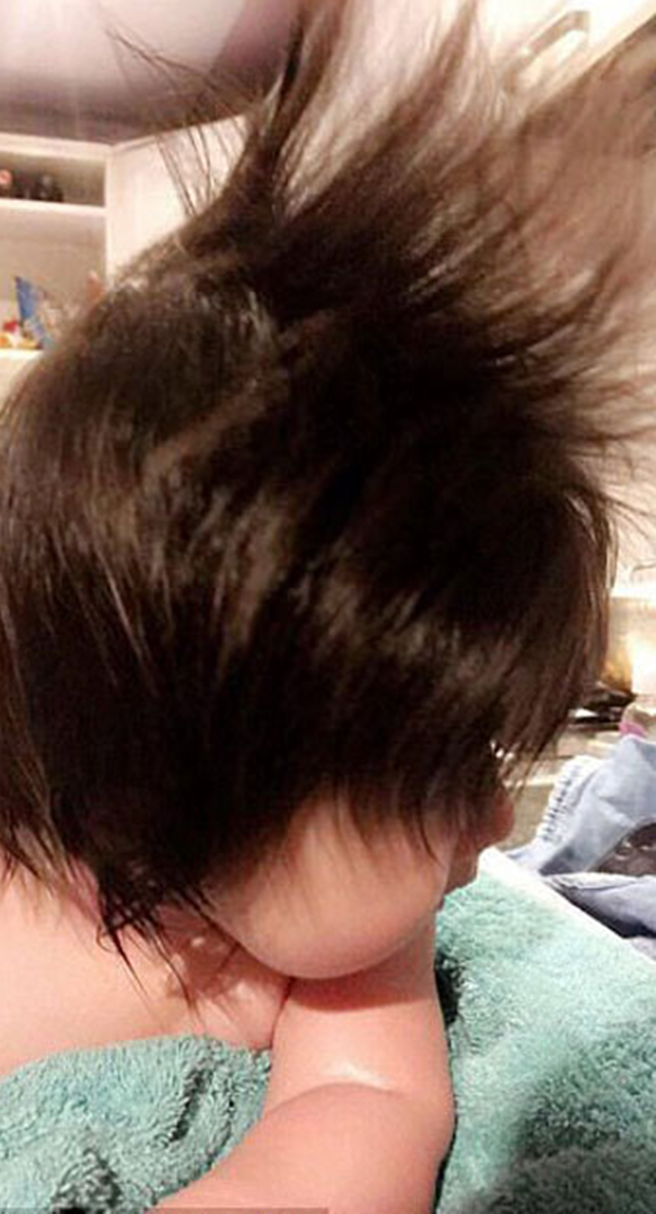 Foto - Bu bebeği görenler gözlerine inanamıyor!