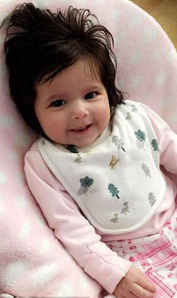 Foto - Bu bebeği görenler gözlerine inanamıyor!