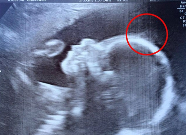 Bu bebeği görenler gözlerine inanamıyor!