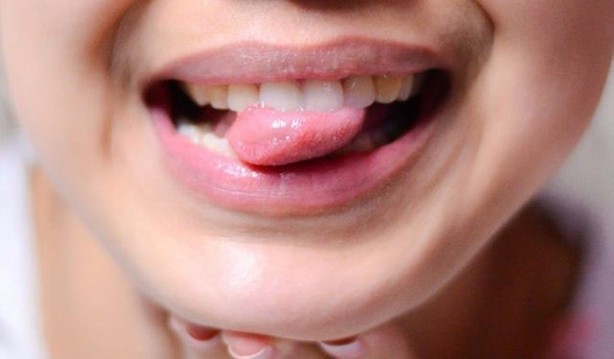 Bu belirtiler dil kanserinin habercisi!