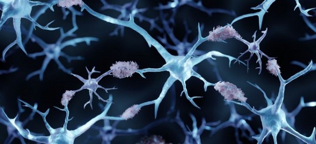 Foto - Bu belirtiler hep göz ardı ediliyor! Oysa hastalık 10 yıl öncesinden teşhis edilebilir