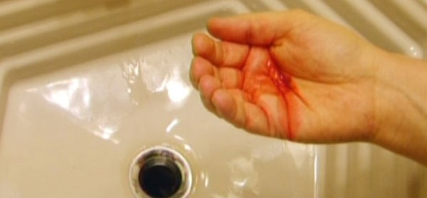 Foto - Bu belirtiler varsa… Akciğer kanserinin 8 sinyali