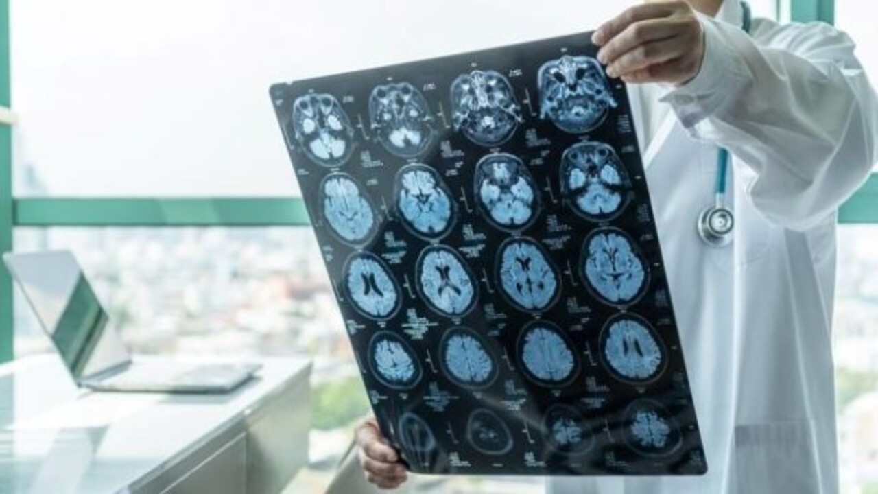 Foto - Bu belirtiler varsa dikkat! Bunamanın erken işareti olabilir