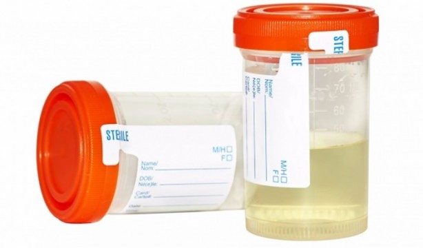 Foto - Bu belirtiler varsa kanser olabilirsiniz!