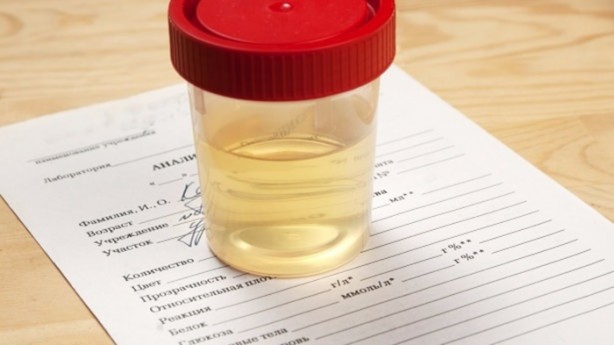 Foto - Bu belirtiler varsa kanser olabilirsiniz!