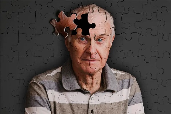 Foto - Bu belirtilere dikkat edin! Alzheimer'ın habercileri 6 yıl önce ortaya çıkıyor