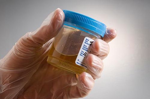 Foto - Bu belirtilere dikkat! Kanser olabilirsiniz!