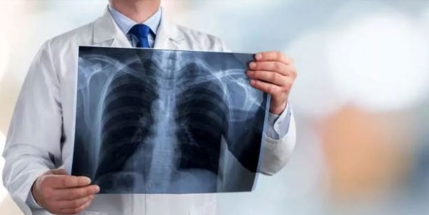 Foto - Bu besinler Akciğerleri temizliyor