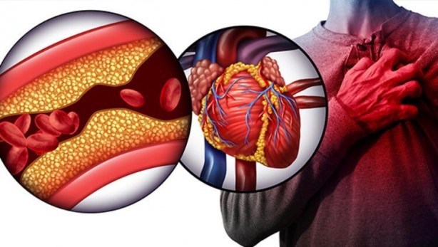 Bu 'bilgiler' öldürebilir! Kalbiniz için bu hataları sakın yapmayın