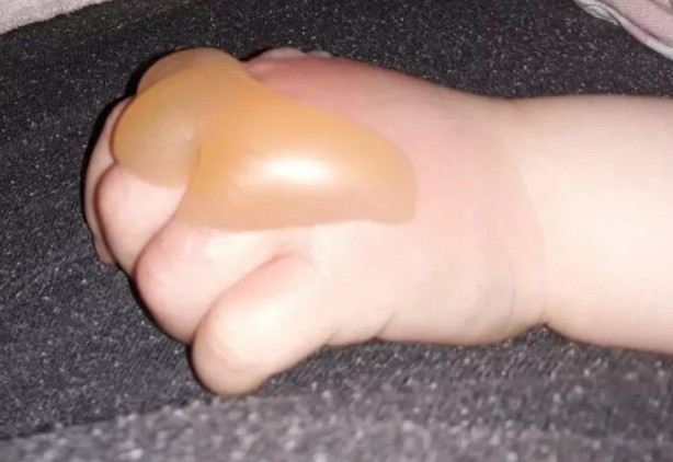 Foto - Bu bitki dünyayı ayağa kaldırdı! Maalesef Türkiye'de de var, dokunanın başına bakın neler geliyor