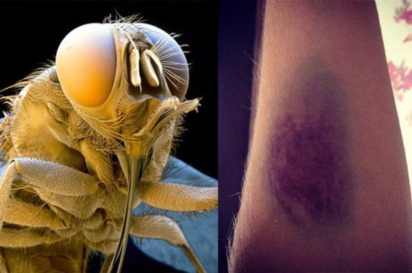 Foto - Bu böcekler ölüm saçıyor!