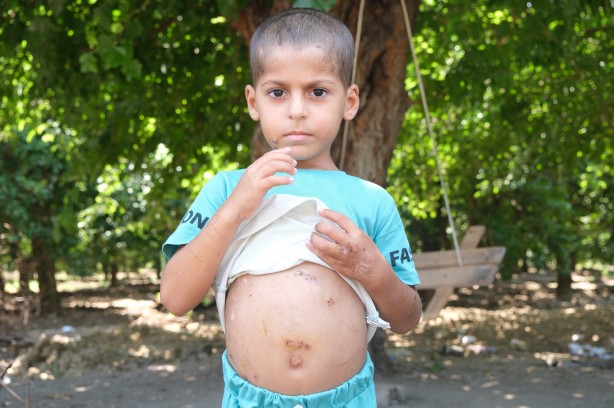 Bu çocuğa iyi bakın! Başıboş köpekler bu hale getirdi