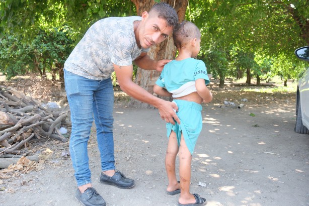 Foto - Bu çocuğa iyi bakın! Başıboş köpekler bu hale getirdi