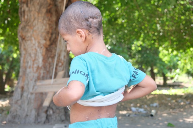 Foto - Bu çocuğa iyi bakın! Başıboş köpekler bu hale getirdi
