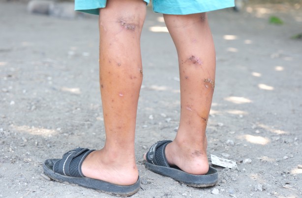 Foto - Bu çocuğa iyi bakın! Başıboş köpekler bu hale getirdi