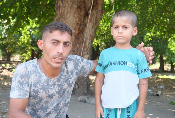 Foto - Bu çocuğa iyi bakın! Başıboş köpekler bu hale getirdi