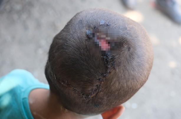 Foto - Bu çocuğa iyi bakın! Başıboş köpekler bu hale getirdi