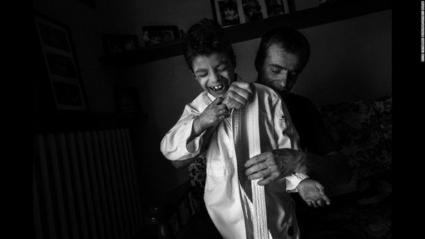 Foto - Bu çocuk gölgede yaşamak zorunda!