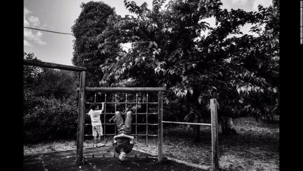 Foto - Bu çocuk gölgede yaşamak zorunda!