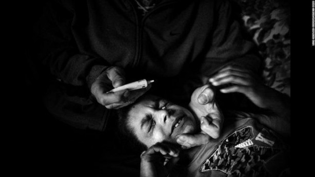 Foto - Bu çocuk gölgede yaşamak zorunda!