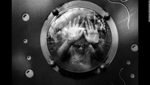 Bu çocuk gölgede yaşamak zorunda!