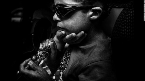 Foto - Bu çocuk gölgede yaşamak zorunda!