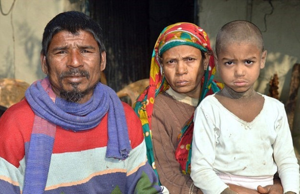 Foto - Bu çocuk günden güne taşa dönüşüyor!