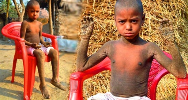 Bu çocuk günden güne taşa dönüşüyor!