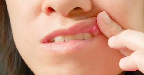 Foto - Bu diş macununu kullananlar dikkat! Dudakları yanakları şişiriyor