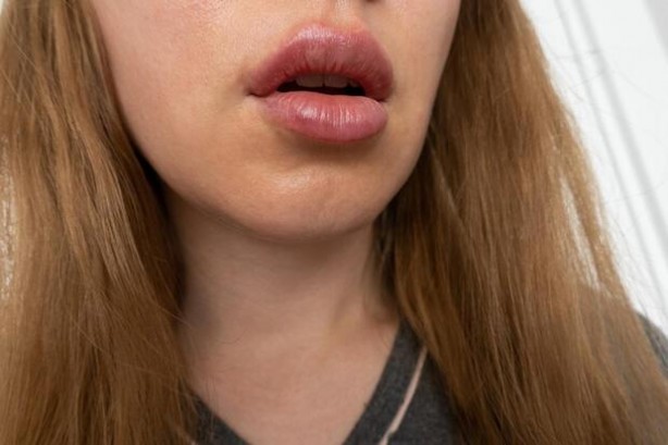 Foto - Bu diş macununu kullananlar dikkat! Dudakları yanakları şişiriyor