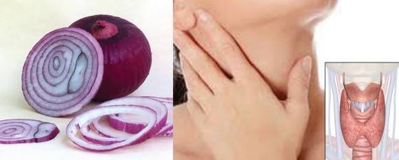 Foto - Bu faydasına inanamayacaksınız! Boynunuza soğan bağlayıp bir süre beklerseniz... 