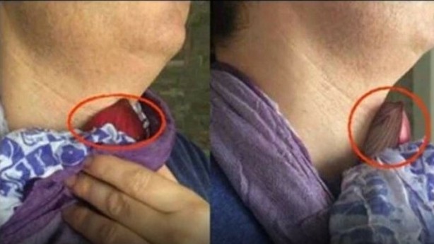 Foto - Bu faydasına inanamayacaksınız! Boynunuza soğan bağlayıp bir süre beklerseniz... 