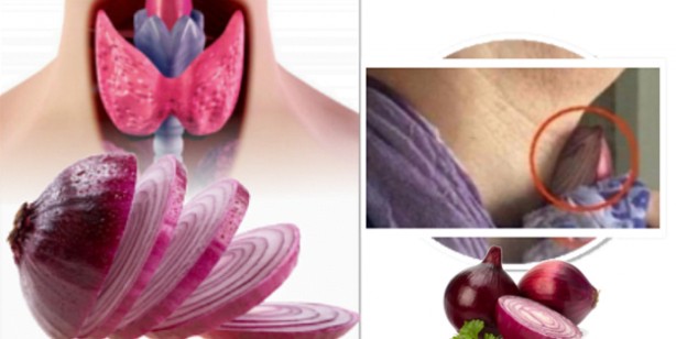 Foto - Bu faydasına inanamayacaksınız! Boynunuza soğan bağlayıp bir süre beklerseniz... 