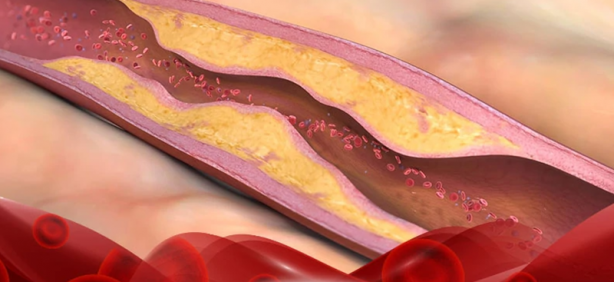 Foto - Bu gıda vücuttaki tüm zehri atıyor