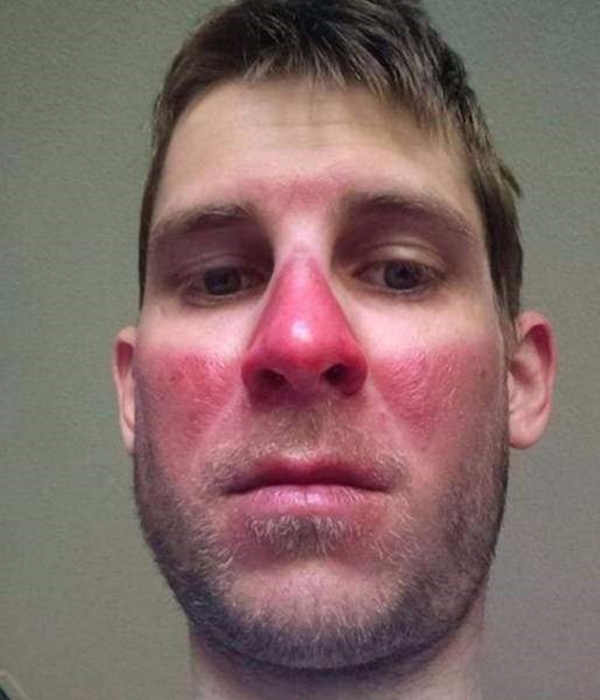 Foto - Bu görüntüler içinizi acıtacak!