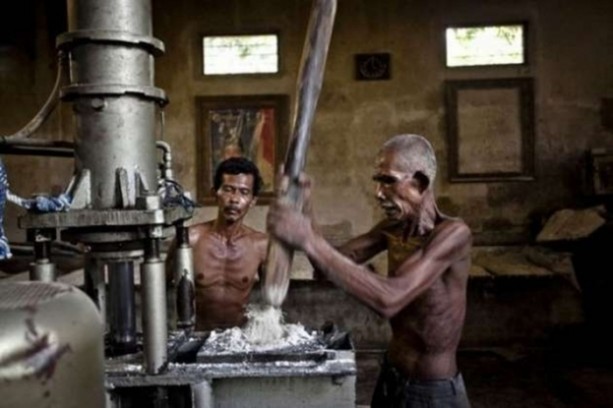 Foto - Bu görüntüleri mideniz kaldırmayabilir!