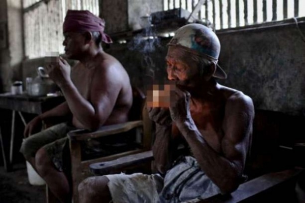 Foto - Bu görüntüleri mideniz kaldırmayabilir!