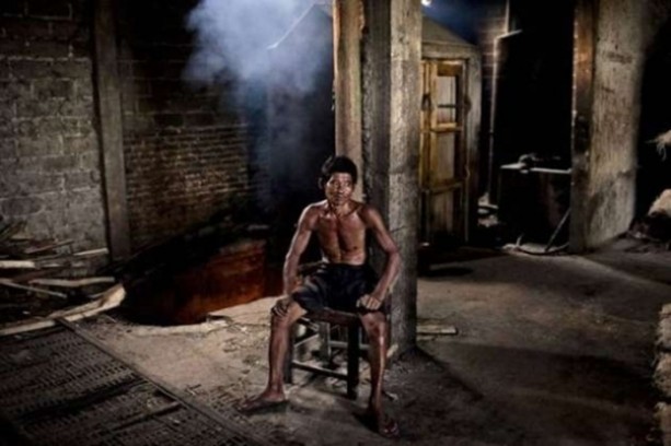 Foto - Bu görüntüleri mideniz kaldırmayabilir!